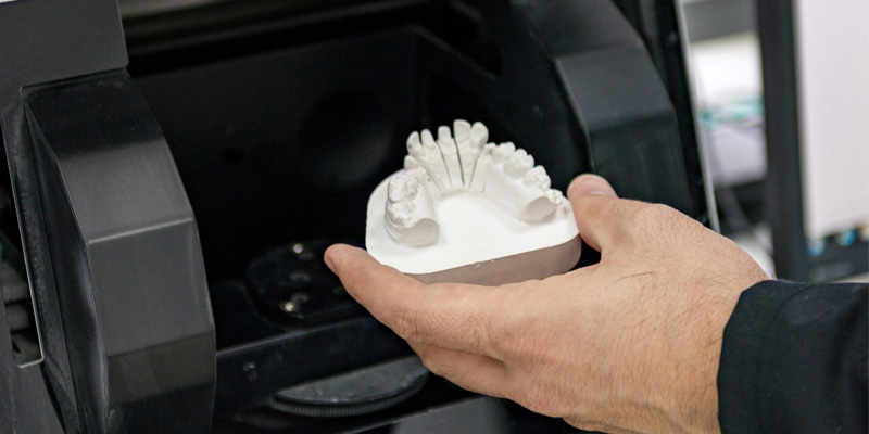 CAD/CAM scanner - Dental Laboratory in Bolton