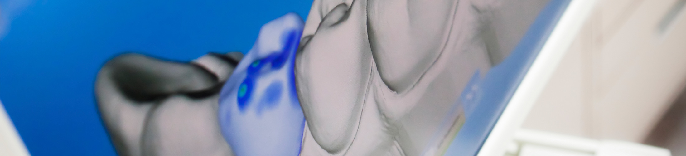 Digital X-ray Of Human Teeth - Dental Laboratory in Bolton